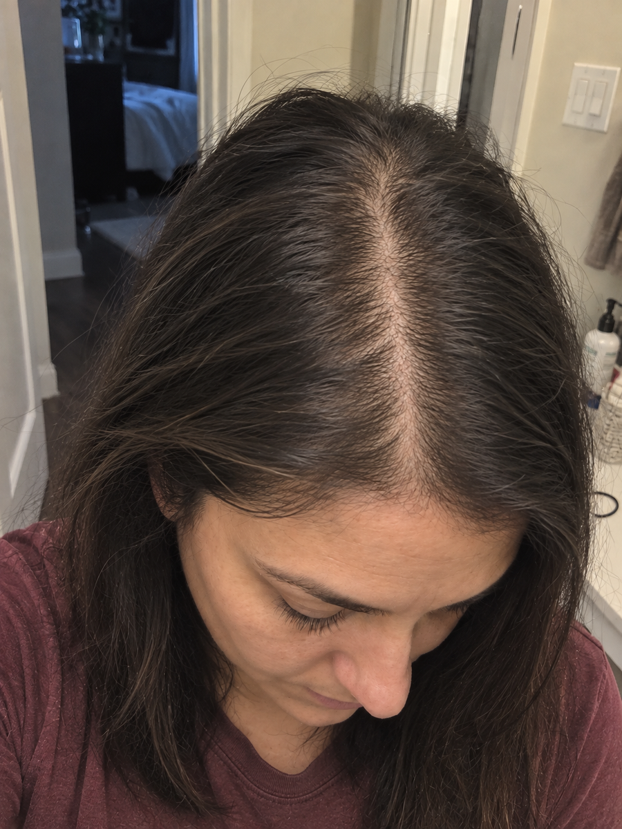 Hair before using the serum