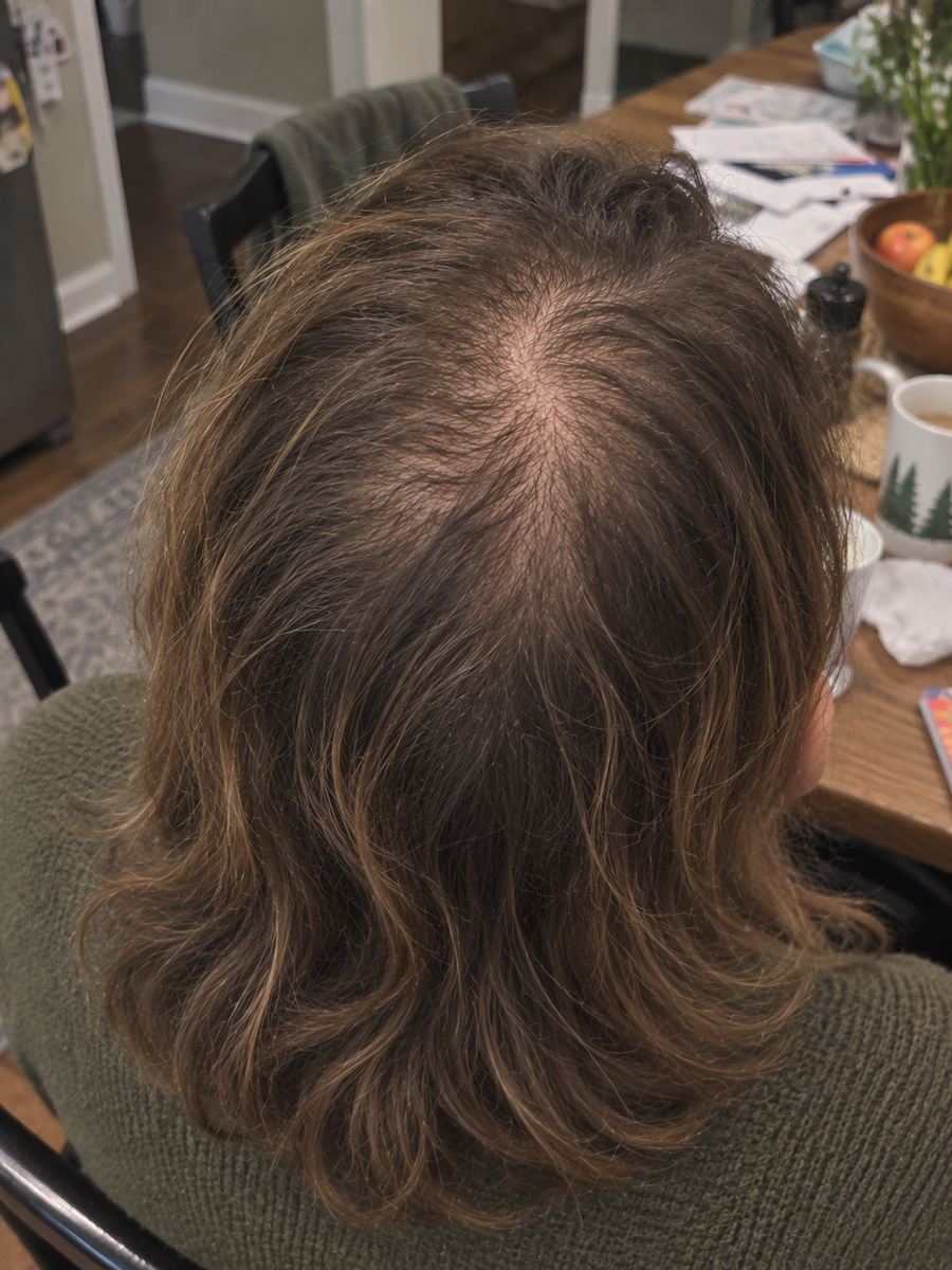 Hair before using the serum